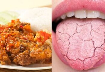 Bahaya Makan Makanan Pedas: Fakta yang Harus Anda Ketahui