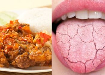 Bahaya Terlalu Sering Makan Makanan Pedas