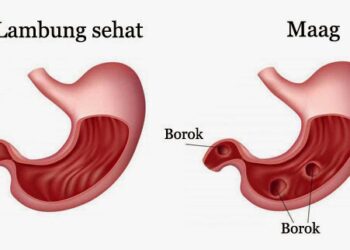 Mencegah Maag Saat Berpuasa Ramadan: Tips dan Pedoman