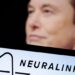 Chip Otak Elon Musk Gagal: Begini Pengakuan Pasien