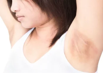 Ketiak Perih Setelah Pakai Deodoran?