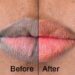 Cara Mencegah dan Mengatasi Bibir Hitam
