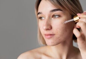 Bolehkah Jerawat Pakai Retinol?