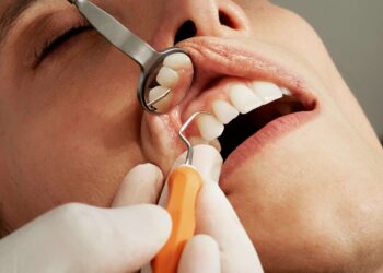 Rahasia Senyum Sehat dan Cerah: Scaling Gigi Penting