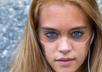 Cara Mencegah Kulit Belang dan Menjaga Kulit Merata