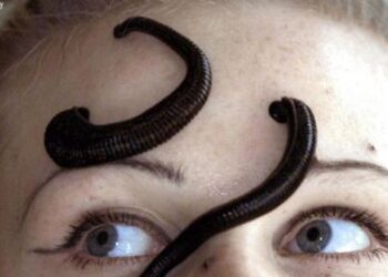 Penanganan Pertama Saat Tergigit Lintah: Panduan Lengkap